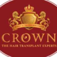 Crownhairtransplant